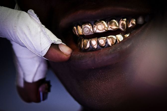 American shot putter Raven Saunders wears gold Olympic-themed grills on August 8. <a href=