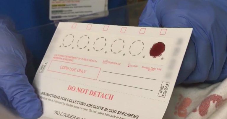 newborn-blood-sample.jpeg